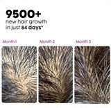 Extreme Hair Growth Oil 100 ML